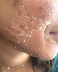 Peeling aux algues zena 100% naturel
