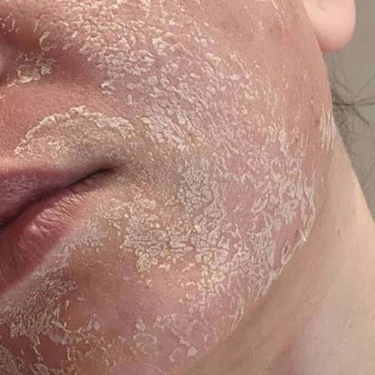 Peeling aux algues (rose de mer)